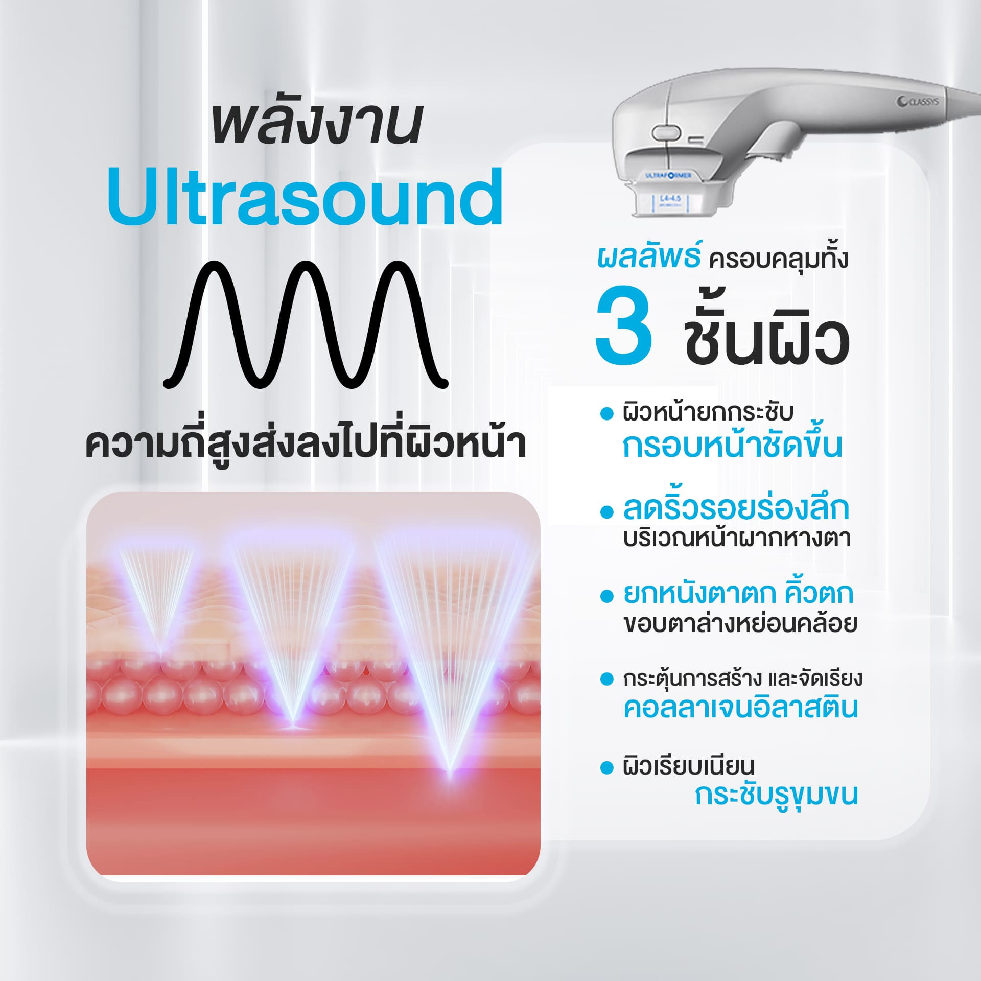 Ultraformer III คืออะไร