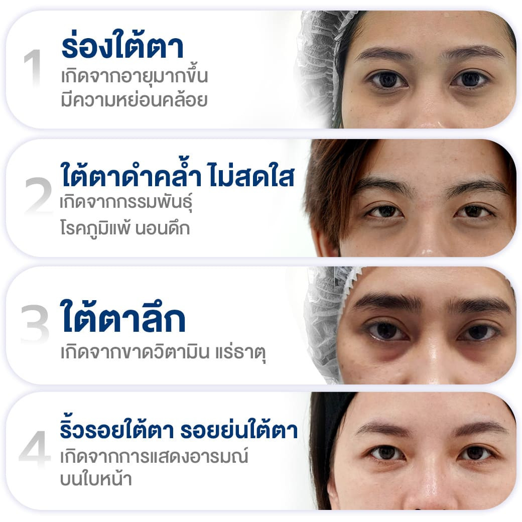 ปัญหาใต้ตา