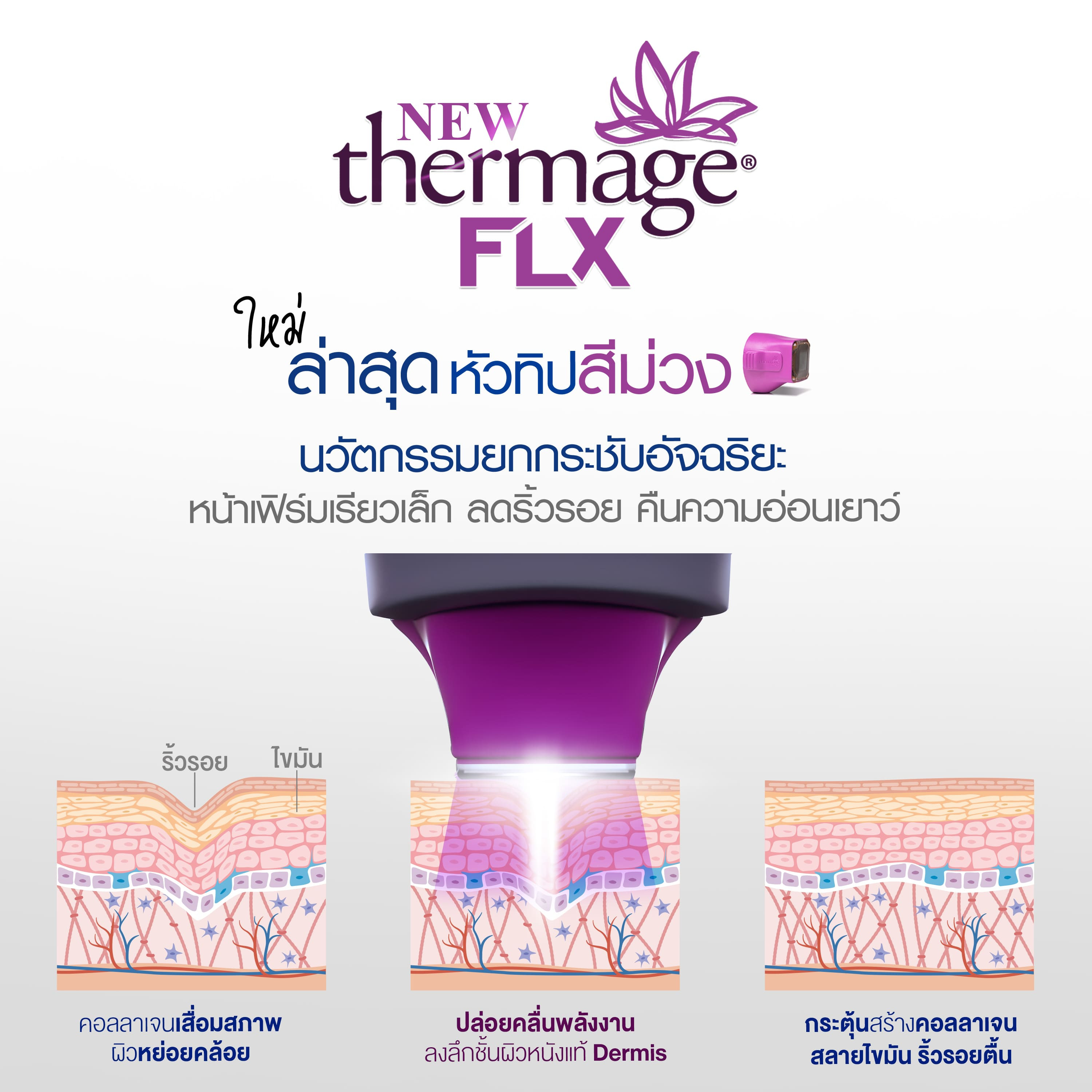 Thermage FLX