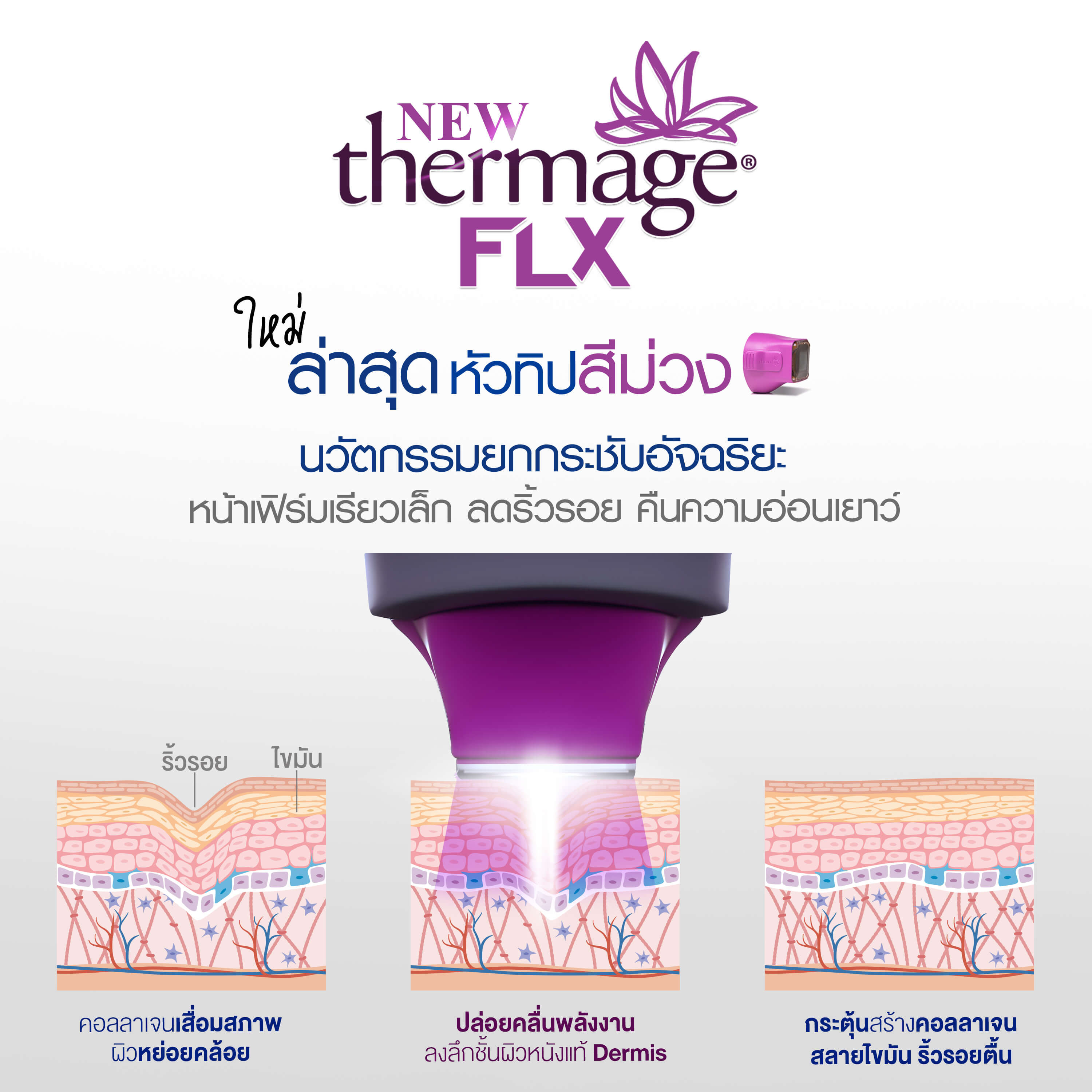 Thermage FLX คืออะไร