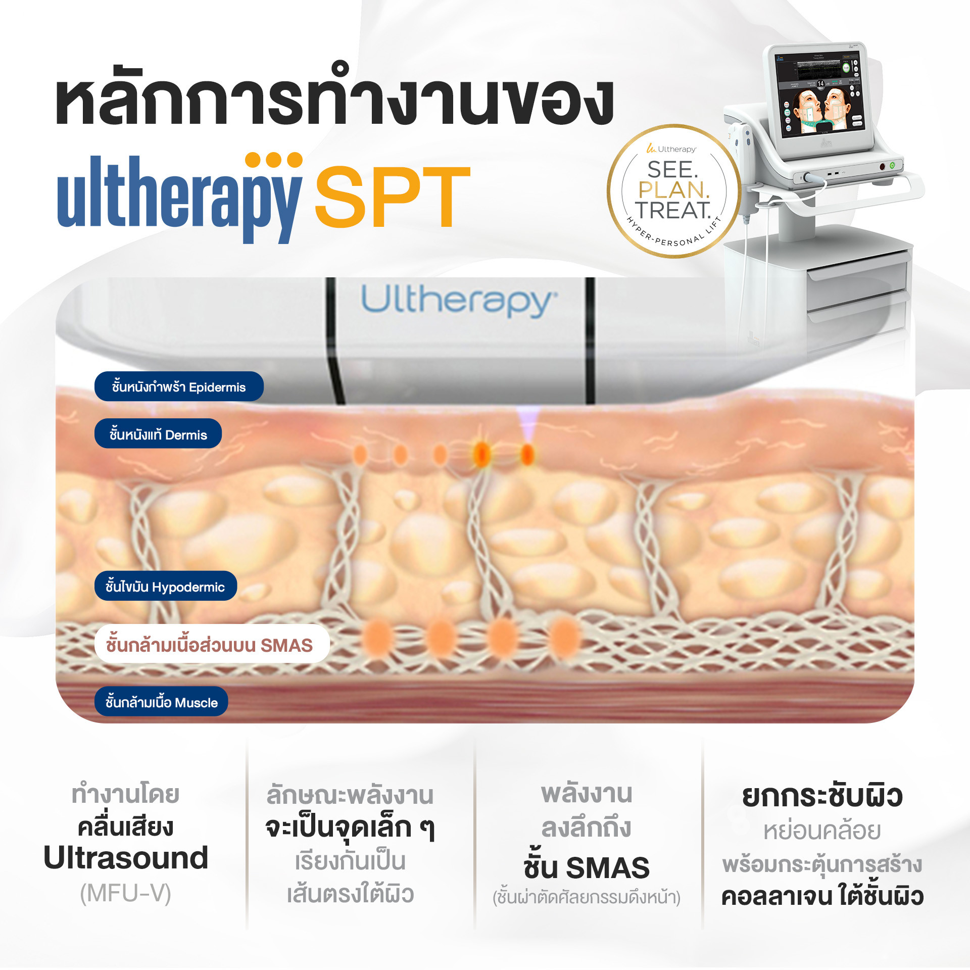 หลักการทำงาน ultherapy spt 