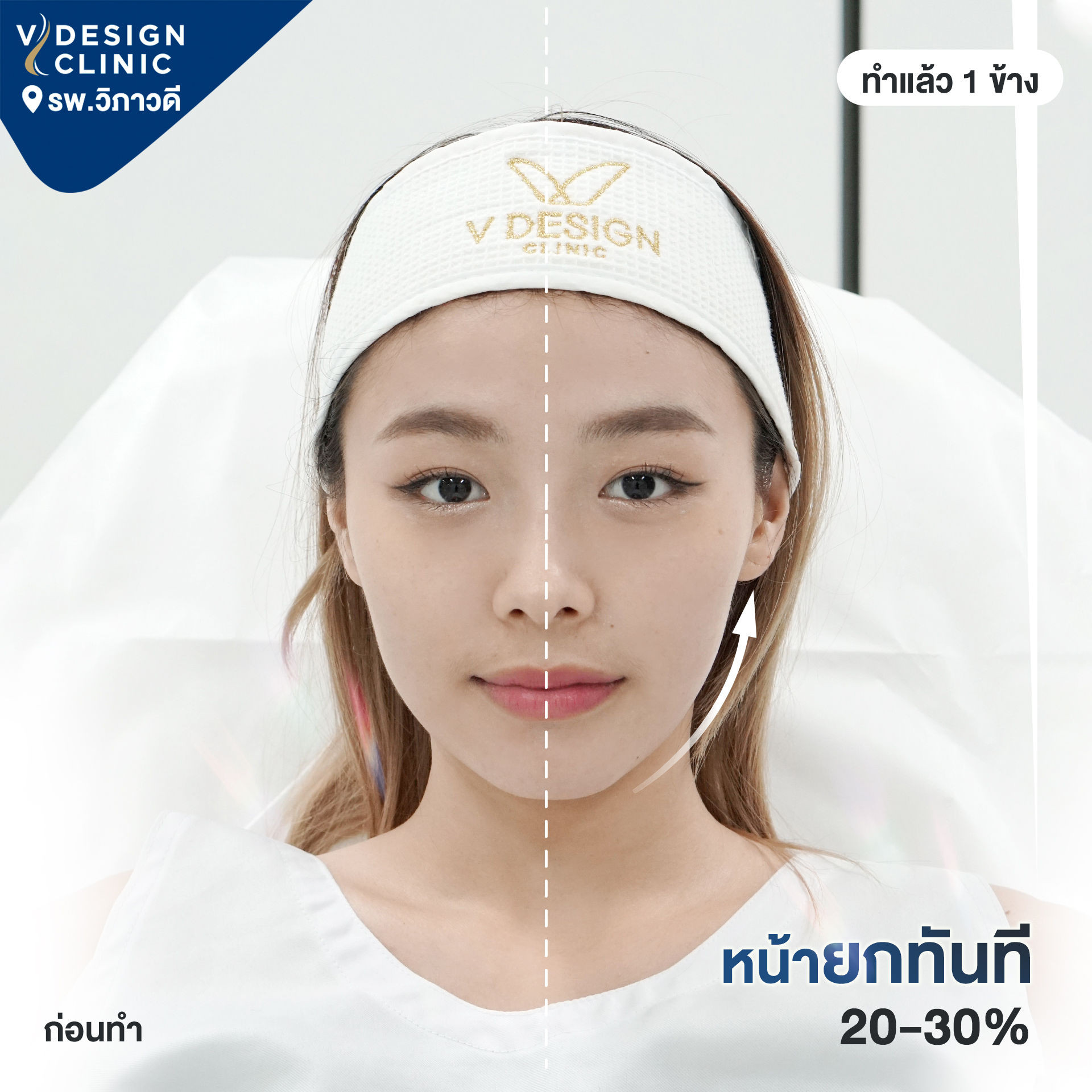 รีวิว Vdesign Clinic